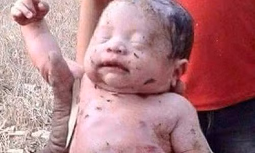 Than ky su song sot em be bi dam, chon song