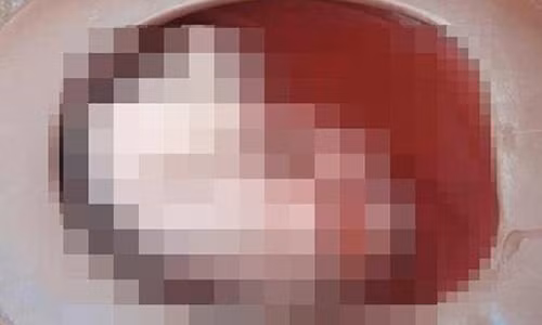 Soc: San phu de roi con xuong bon cau moi biet minh mang thai