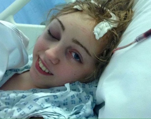 Mặc dù việc điều trị vô cùng mệt mỏi và đau đớn nhưng cô gái vẫn luôn lạc quan, đầy quyết tâm chống lại bệnh tật.