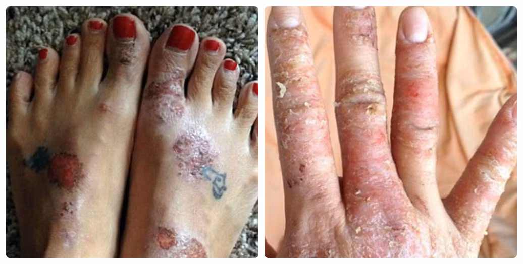 Cô gái 27 tuổi tới từ Colorado này gần như phải cách ly với bạn trai của mình.