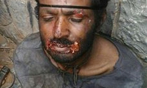 Người đàn ông đang gây xôn xao dư luận Yemen.