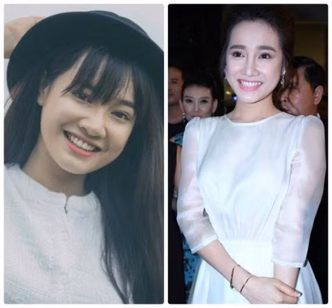 Nhã Phương bị nghi phẫu thuật thẩm mỹ. Thuở mới dấn thân vào điện ảnh, mũi của Nhã Phương thấp, cánh mũi to, khuôn mặt bầu bĩnh hiện nét ngây thơ, trong sáng. Thế nhưng, những ngày gần đây xuất hiện trên truyền thông, người ta thấy Nhã Phương đã phẫu thuật mũi, làm cho mũi cao hơn.