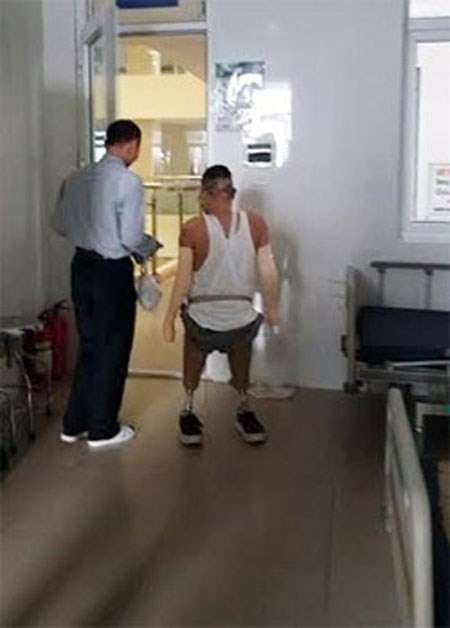 Đến nay, chiến sỹ Dương đã có thể tự đi một mình bằng chân giả. Ảnh: Phượng Hoàng