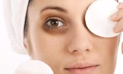 Nhung dieu chua biet ve benh tham quang mat