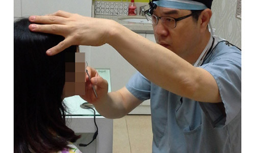 Thăm khám trước khi cắt mỡ mí mắt.