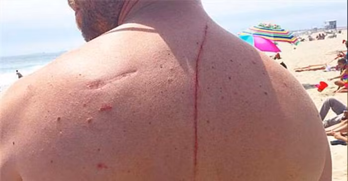 “Cham tran” ca map, khong ngo dieu do da cuu mang anh