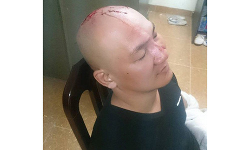 Va quet xe thanh nien cam dao lao vao au da