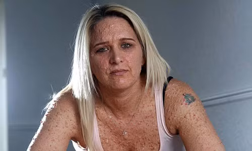 Xot xa nguoi phu nu da san sui nhu ca sau