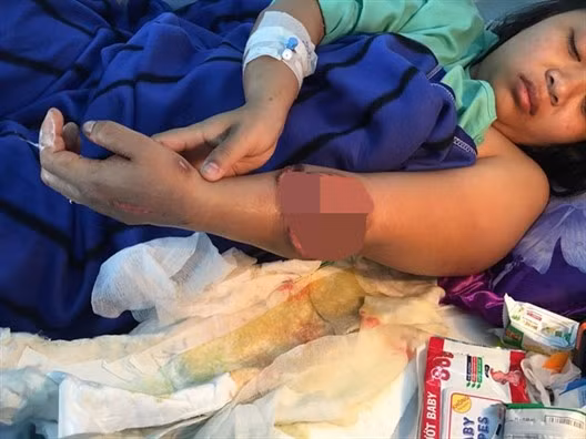 Co gai 21 tuoi hoi sinh canh tay ky dieu-Hinh-2