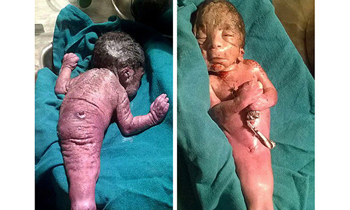 Soc: “Nguoi ca” vua duoc sinh ra tai An Do