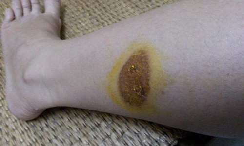 Meo chua phong bo xe may khong de lai seo