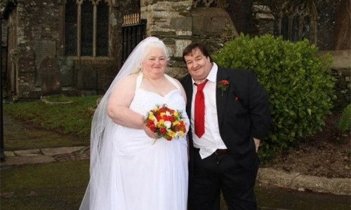 Phau thuat giam can de lam duoc 