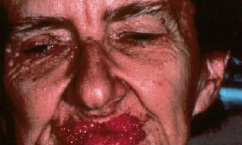 Hai hung can benh ky quac tu an thit chinh minh