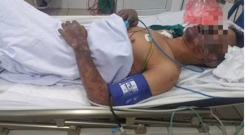 Ham an tiet canh lon man coi chung mat het chan tay