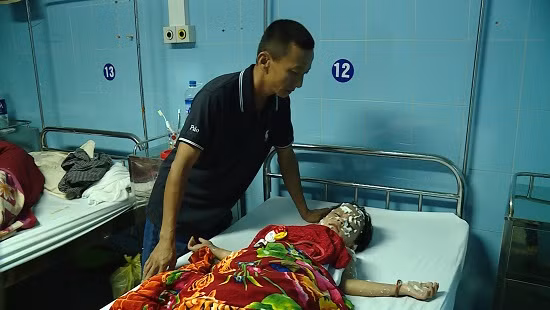 Quang Binh Chum bong bay phat no 9 nguoi bi thuong