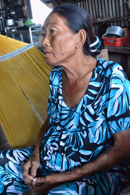 Nước da xạm đen, quăn queo và cái bụng trương to bất thường.