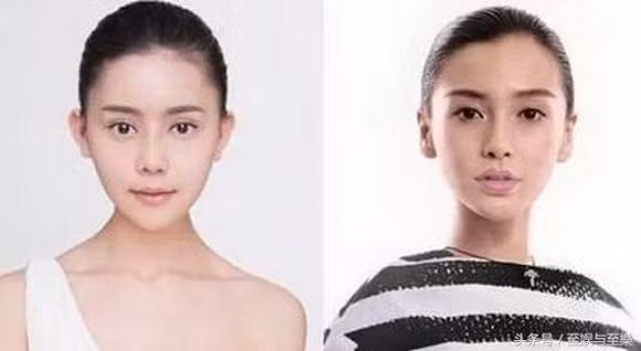 Khi khuôn mặt hết sưng nề, Tiểu Mỹ (trái) đã có đôi mắt, sống mũi, khuôn cằm giống với Angela Baby (phải).