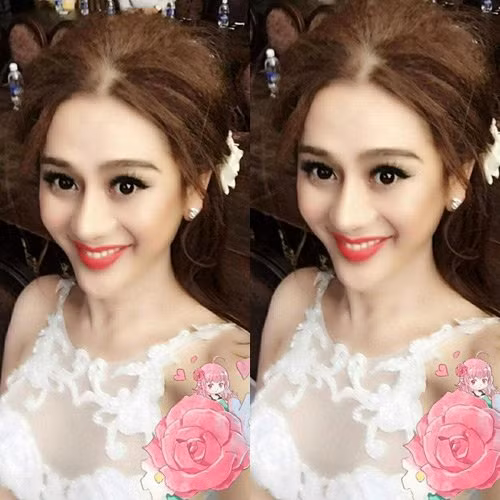 Lam Chi Khanh ly giai ve khuon mat nhon bat thuong