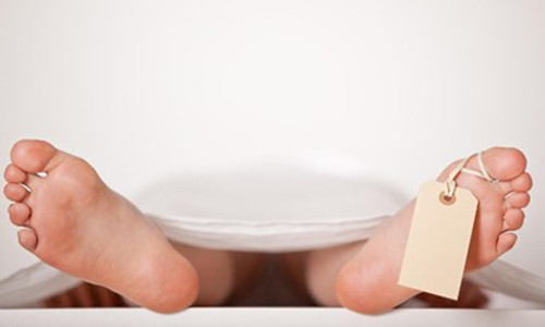 Kho do mui hoi chan khien bi tuong nham la chet thoi