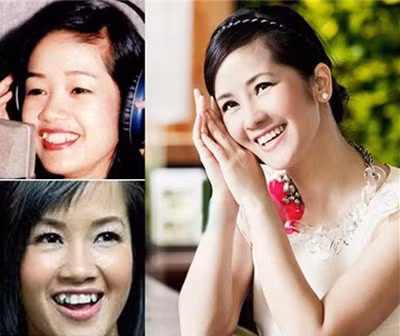Tuy nhiên, cô đã nhổ bỏ chúng để có hàm răng đều.