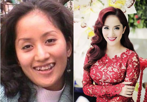 Khánh Thi có hàm răng khá khấp khểnh. Quyết định nhổ và 'đại tu' hàm răng của cô là vô cùng chính xác.