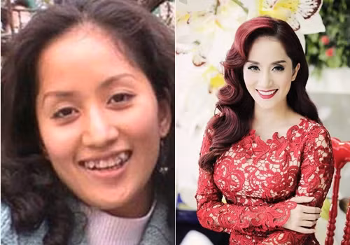 Khánh Thi có hàm răng khá khấp khểnh. Quyết định nhổ và 'đại tu' hàm răng của cô là vô cùng chính xác.