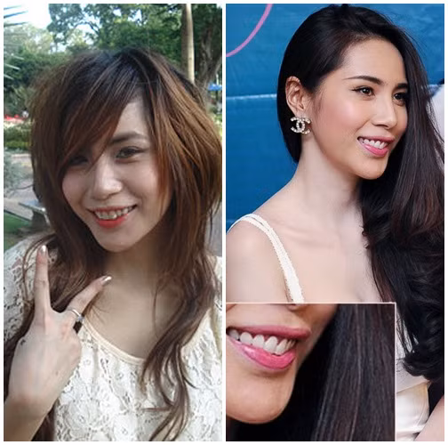 Hàm răng của nữ ca sĩ Việt này cũng trắng đều lên theo thời gian.