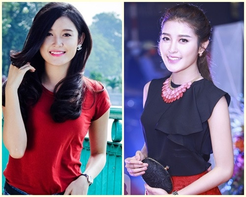  Á hậu Việt Nam Huyền My từng khiến nhiều khán giả tiếc nuối khi nhổ đi chiếc răng khểnh duyên dáng.