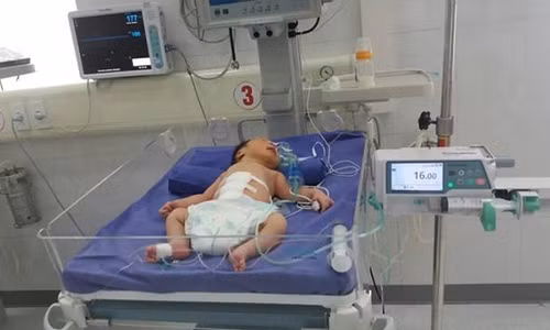 Cuu song be sinh non lo noi tang ra ngoai thanh bung