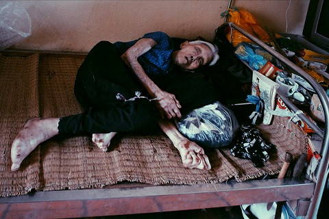 Nằm một chỗ trên chiếc giường lỉnh kỉnh những chăn gối, xống áo cũ là cụ Trần Thị Miên (93 tuổi, Bắc Ninh). Cũng như bà Hiền hay nhiều mảnh đời khác trong trại phong, cụ Miên là người phụ nữ tột cùng bất hạnh. Nỗi đau về thể xác, nỗi khắc khoải, day dứt về tinh thần luôn thường trực trong cụ kể từ ngày phát bệnh. Chồng ruồng bỏ, cô con gái nhỏ chưa đầy 2 tháng tuổi cũng phải rời xa vì sốc thuốc. Đến tận bây giờ, khi chẳng thể minh mẫn, cụ vẫn đau đáu nói với những người vừa mới gặp về một người con gái đẹp, đôi mắt tròn to, mái tóc đen dài.