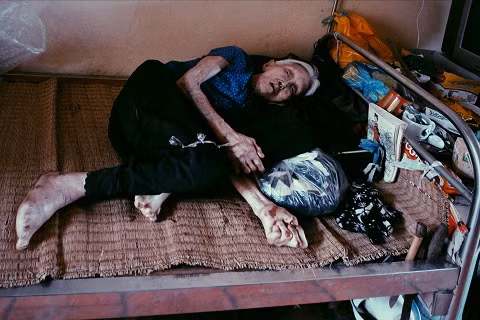 Nằm một chỗ trên chiếc giường lỉnh kỉnh những chăn gối, xống áo cũ là cụ Trần Thị Miên (93 tuổi, Bắc Ninh). Cũng như bà Hiền hay nhiều mảnh đời khác trong trại phong, cụ Miên là người phụ nữ tột cùng bất hạnh. Nỗi đau về thể xác, nỗi khắc khoải, day dứt về tinh thần luôn thường trực trong cụ kể từ ngày phát bệnh. Chồng ruồng bỏ, cô con gái nhỏ chưa đầy 2 tháng tuổi cũng phải rời xa vì sốc thuốc. Đến tận bây giờ, khi chẳng thể minh mẫn, cụ vẫn đau đáu nói với những người vừa mới gặp về một người con gái đẹp, đôi mắt tròn to, mái tóc đen dài.