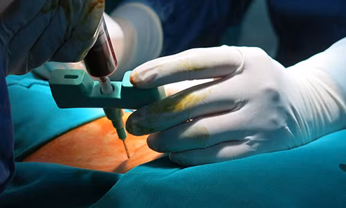 Ghep te bao goc tri roi loan dai tieu tien