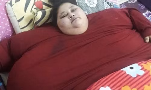 Nguoi phu nu nang 500kg duoc phau thuat giam beo