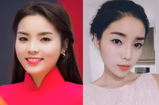 Su that ve tin don hoa hau Ky Duyen phau thuat got cam-Hinh-3