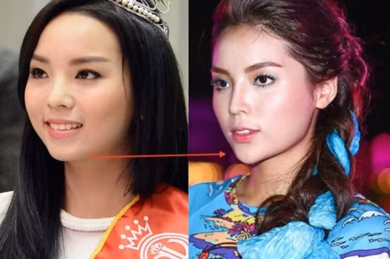 Su that ve tin don hoa hau Ky Duyen phau thuat got cam-Hinh-4