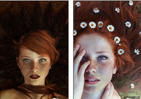 Những nốt tàn nhang làm bạn khác lạ với mọi người, quan trọng là cách bạn đón nhận nó.