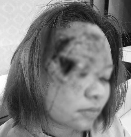 Nhiều Facebook-er nhìn nhận sự việc khá nghiêm trọng. Bạn có tên C.C bình luận: "Hồi chuông báo động cho chị em hãy tỉnh ngộ, trước tiền và sắc mà quên đi cái tâm hồn. Hãy thức tỉnh đi!". "Những chất cực độc hại bán tràn lan bên ngoài, ai cũng có thể mua được. Phải đề nghị khống chế việc buôn bán không kiểm soát này lại", Sa Leng viết.