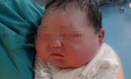 An qua nhieu chao, san phu sinh em be khong lo nang 6,6kg