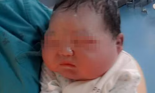 An qua nhieu chao, san phu sinh em be khong lo nang 6,6kg