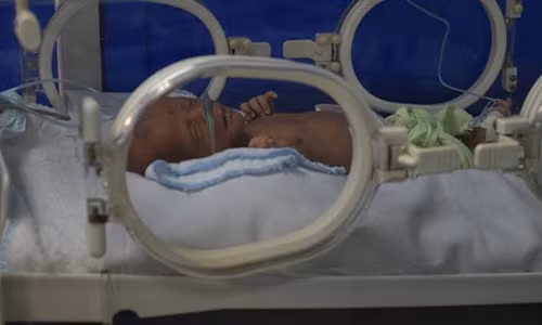 Sự sống lay lắt của bé trai nặng 1,5 kg Su song lay lat cua be trai nang 1,5 kg