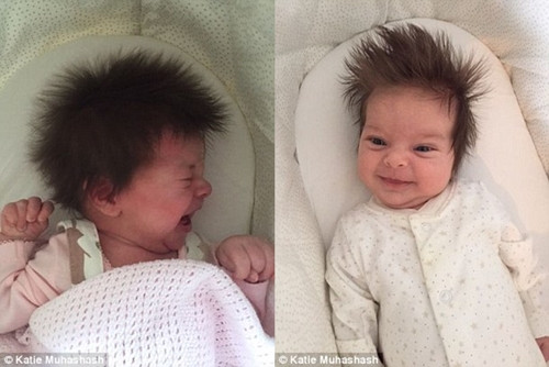 Bà mẹ Farrah gọi con gái 3 tháng tuổi Katie Mushashash là "Em bé lông”.