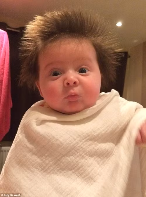 Bé Lottie Toole 12 tuần tuổi, bé vốn sinh non 5 tuần, tuy nhiên có rất nhiều tóc.