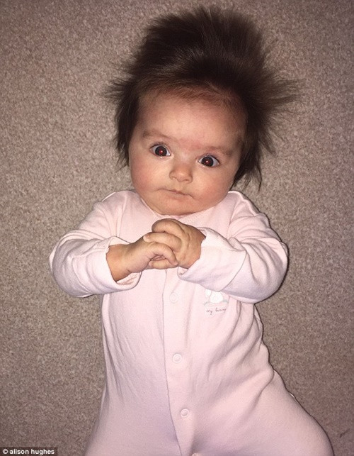 Con gái 18 tuần tuổi của cô Alison: “Đi đâu người ta cũng chú ý tới chúng tôi vì mái tóc của con bé”.