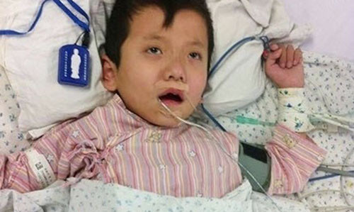 Giet ran dai 2m, ca gia dinh bi tra thu tan doc