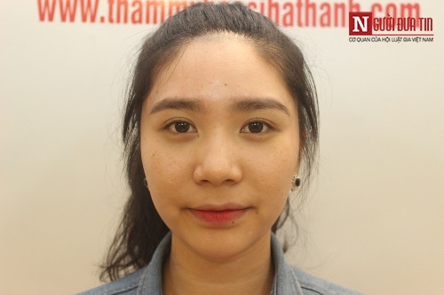 Được biết, chi phí thực hiện cho một ca phẫu thuật thu hẹp khuôn miệng hiện không quá tốn kém: "Hầu hết khách hàng có nhu cầu thực hiện chỉ phải bỏ ra từ 8-10 triệu đồng là có thể có 1 khuôn miệng xinh xắn, xóa đi khiếm khuyết của cơ thể".