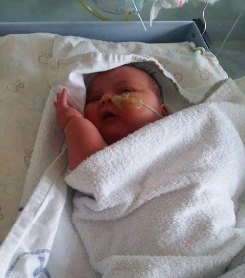 Khi mang bầu bé Thomas Hutchinson (sinh sống tại Wallasey, Merseyside, Anh), nhiều người đã nghĩ rằng bà mẹ Leanne mang thai đôi bởi bụng của cô quá lớn. Cậu bé được sinh ra bằng phương pháp đẻ mổ trước ngày dự sinh 3 tuần vì lo sợ quá trình sinh thường có thể xảy ra những rủi ro đáng tiếc.