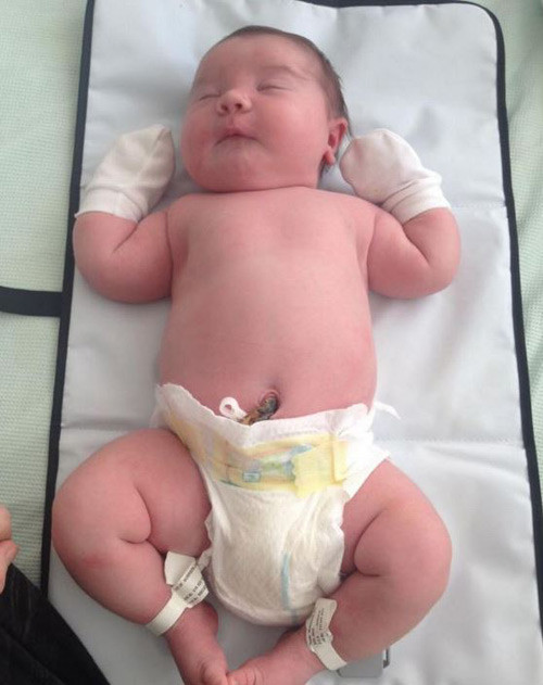 Thậm chí có bé sơ sinh chào đời nặng tới 7kg.