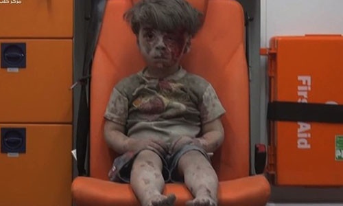 Anh be trai Syria bi thuong gay soc du luan