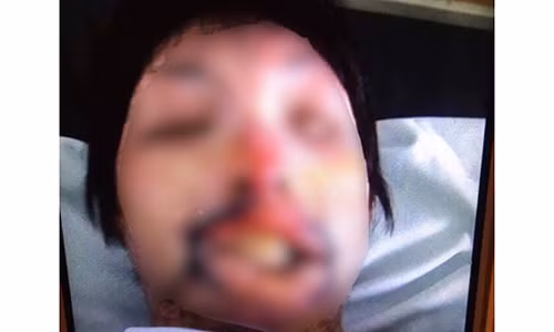 Dan mang "soc" voi guong mat 9X bien dang khi bi chong "thieu song"