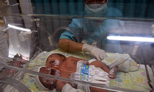 Be gai chao doi co 2 dau vi hoi chung hiem gap